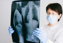 Cáncer de pulmón: Especialistas alertan aumento de casos en personas no fumadoras y llaman a reforzar la detección temprana