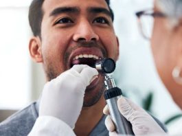 Cáncer oral un desafío silencioso para la salud en Chile