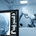 Cirugías cerebrales por vía nasal una técnica cada vez más frecuente y menos invasiva