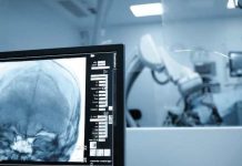 Cirugías cerebrales por vía nasal: una técnica cada vez más frecuente y menos invasiva Cirugías cerebrales por vía nasal una técnica cada vez más frecuente y menos invasiva