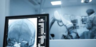 Cirugías cerebrales por vía nasal una técnica cada vez más frecuente y menos invasiva