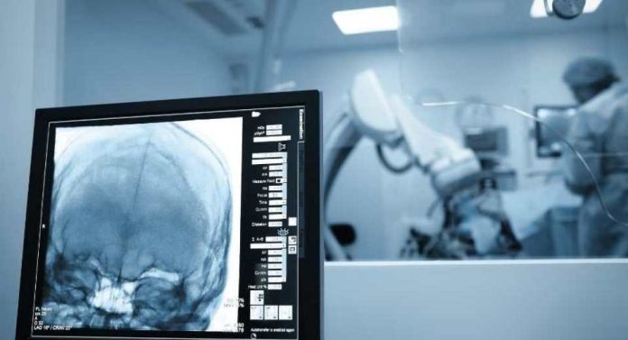 Cirugías cerebrales por vía nasal una técnica cada vez más frecuente y menos invasiva Cirugías cerebrales por vía nasal una técnica cada vez más frecuente y menos invasiva