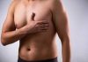 Con la llegada del verano, aumentan las consultas por ginecomastia: la cirugía masculina más demandada de la temporada Con la llegada del verano, aumentan las consultas por ginecomastia la cirugía masculina más demandada de la temporada