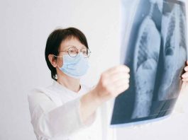 Chile lidera la lucha contra el cáncer de pulmón en Latinoamérica con cifra récord de estudios clínicos 