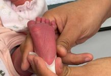 Hospital Regional de Concepción es uno de los tres centros de Chile que analiza nuevo examen para recién nacidos en el sistema público Hospital Regional de Concepción es uno de los tres centros de Chile que analiza nuevo examen para recién nacidos en el sistema público