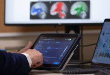 Mayo Clinic mapea ondas cerebrales de los pacientes para personalizar tratamiento de la epilepsia