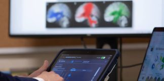 Mayo Clinic mapea ondas cerebrales de los pacientes para personalizar tratamiento de la epilepsia