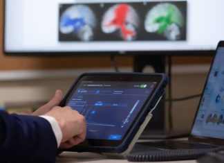 Mayo Clinic mapea ondas cerebrales de los pacientes para personalizar tratamiento de la epilepsia