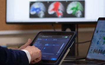 Mayo Clinic mapea ondas cerebrales de los pacientes para personalizar tratamiento de la epilepsia Mayo Clinic mapea ondas cerebrales de los pacientes para personalizar tratamiento de la epilepsia