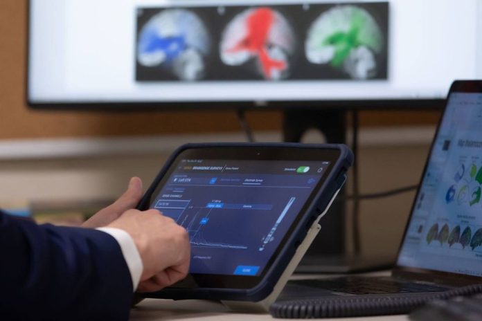 Mayo Clinic mapea ondas cerebrales de los pacientes para personalizar tratamiento de la epilepsia