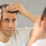 ¿Sufre de caída del cabello? Sepa cuándo es tiempo de consultar a un médico ¿Sufre de caída del cabello Sepa cuándo es tiempo de consultar a un médico