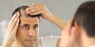 ¿Sufre de caída del cabello Sepa cuándo es tiempo de consultar a un médico