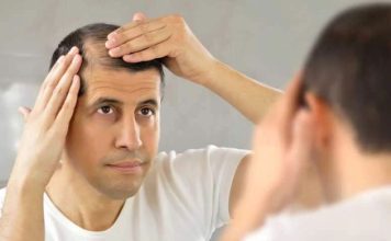 ¿Sufre de caída del cabello Sepa cuándo es tiempo de consultar a un médico