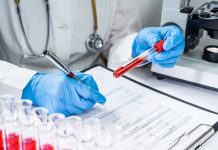 Anemia en jóvenes: la condición silenciosa que avanza entre los jóvenes Anemia en jóvenes: la condición silenciosa que avanza entre los jóvenes