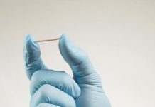 Implante subdérmico: lo que sí y lo que no sobre peso, fertilidad y seguridad