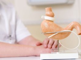 Estudio revela claves para enfrentar el Síndrome de Dumping tras cirugías bariátricas Estudio revela claves para enfrentar el Síndrome de Dumping tras cirugías bariátricas