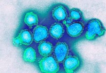 influenza A(H3N2) en Chile