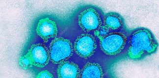 influenza A(H3N2) en Chile