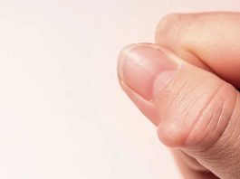 ¿Lipoma? Especialista en Salud explica qué es y cuándo consultar al médico