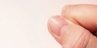 ¿Lipoma? Especialista en Salud explica qué es y cuándo consultar al médico