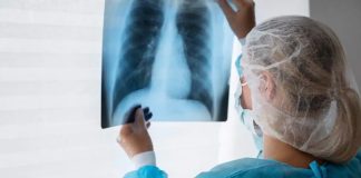 Pacientes con cáncer de pulmón quedan sin tratamiento por quiebres de stock en hospitales públicos