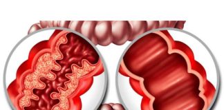 Resultados en minutos: un avance clave para el manejo de la enfermedad inflamatoria intestinal