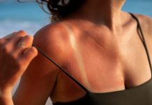 Verano y piel al límite: los problemas estéticos que más aumentan con el sol… y cómo prevenirlos Verano y piel al límite: los problemas estéticos que más aumentan con el sol… y cómo prevenirlos