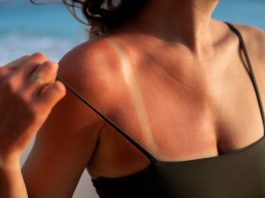 Verano y piel al límite: los problemas estéticos que más aumentan con el sol… y cómo prevenirlos 