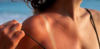 Verano y piel al límite: los problemas estéticos que más aumentan con el sol… y cómo prevenirlos 