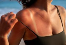 Verano y piel al límite: los problemas estéticos que más aumentan con el sol… y cómo prevenirlos
