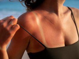 Verano y piel al límite: los problemas estéticos que más aumentan con el sol… y cómo prevenirlos Verano y piel al límite: los problemas estéticos que más aumentan con el sol… y cómo prevenirlos