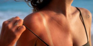 Verano y piel al límite: los problemas estéticos que más aumentan con el sol… y cómo prevenirlos