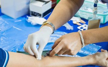 ¿Qué hacer si su examen de triglicéridos está alto? Consejos para cuidar la salud cardiovascular