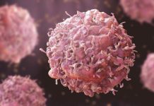 Cáncer en Chile: El desafío de alcanzar el 70% de supervivencia mediante la medicina de precisión y prevención Cáncer en Chile: El desafío de alcanzar el 70% de supervivencia mediante la medicina de precisión y prevención