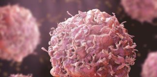 Cáncer en Chile: El desafío de alcanzar el 70% de supervivencia mediante la medicina de precisión y prevención