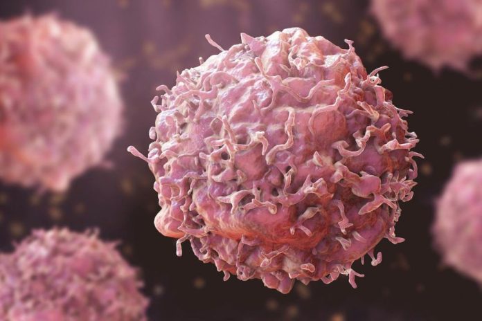 Cáncer en Chile El desafío de alcanzar el 70% de supervivencia mediante la medicina de precisión y prevención Cáncer en Chile: El desafío de alcanzar el 70% de supervivencia mediante la medicina de precisión y prevención