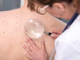 Chequeos gratuitos de lunares en Reñaca: el 90% de los casos de cáncer de piel son curables si se detectan a tiempo Chequeos gratuitos de lunares en Reñaca: el 90% de los casos de cáncer de piel son curables si se detectan a tiempo