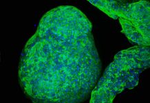 Crean organoides de páncreas ‘cyborg’ capaces de estimular la secreción de insulina