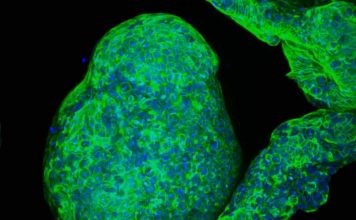 Crean organoides de páncreas ‘cyborg’ capaces de estimular la secreción de insulina