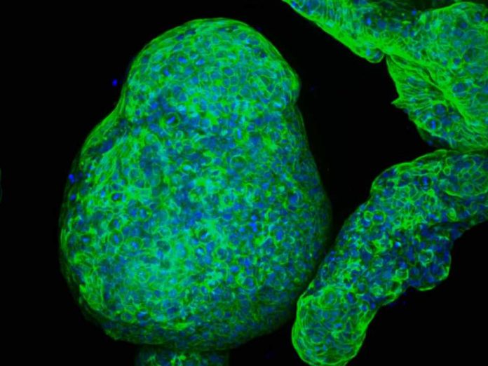 Crean organoides de páncreas ‘cyborg’ capaces de estimular la secreción de insulina