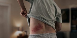 El impacto oculto del herpes zóster: aumenta en un 40% el riesgo de sufrir un accidente cardiovascular