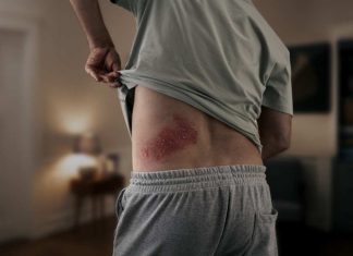 El impacto oculto del herpes zóster: aumenta en un 40% el riesgo de sufrir un accidente cardiovascular