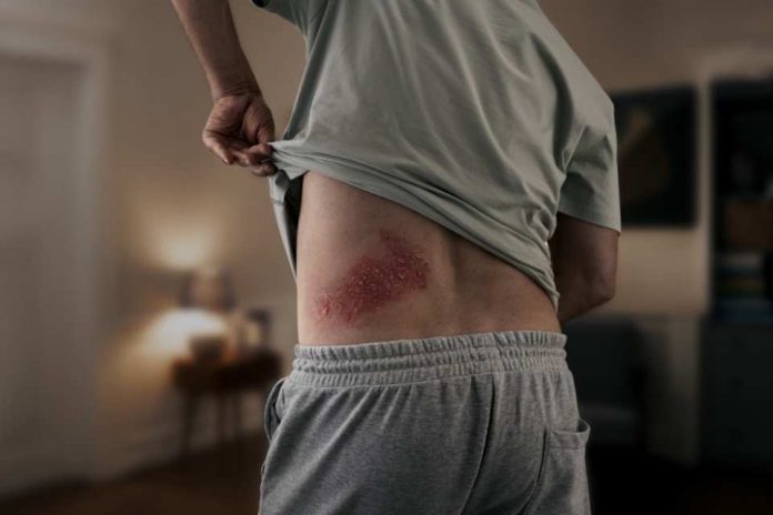 El impacto oculto del herpes zóster: aumenta en un 40% el riesgo de sufrir un accidente cardiovascular