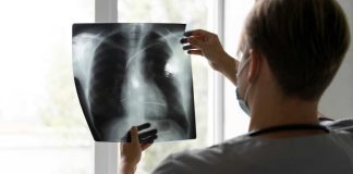 Enfermedad Pulmonar Obstructiva Crónica: cuáles son sus causas y riesgos