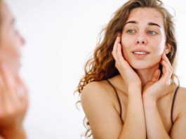 HealthTech chilena redefine la dermatología: diagnóstico y tratamiento asincrónico para el acné y la rosácea