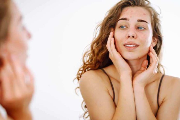 HealthTech chilena redefine la dermatología diagnóstico y tratamiento asincrónico para el acné y la rosácea HealthTech chilena redefine la dermatología: diagnóstico y tratamiento asincrónico para el acné y la rosácea