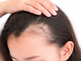 La caída del pelo no es sólo genética: estrés, malos hábitos y alimentación deficiente afectan a mujeres de cualquier edad