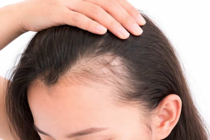 La caída del pelo no es sólo genética: estrés, malos hábitos y alimentación deficiente afectan a mujeres de cualquier edad