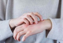 No solo el sol: cinco exposiciones comunes que pueden dañar tu piel en la recta final de las vacaciones