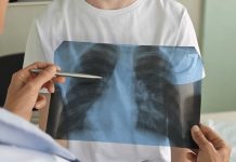 Con la vuelta a la rutina escolar en Chile, las fracturas infantiles son más frecuentes de lo que se cree